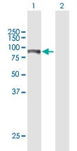 Itpkb Antibody Ab171984  Western Blot Img157586