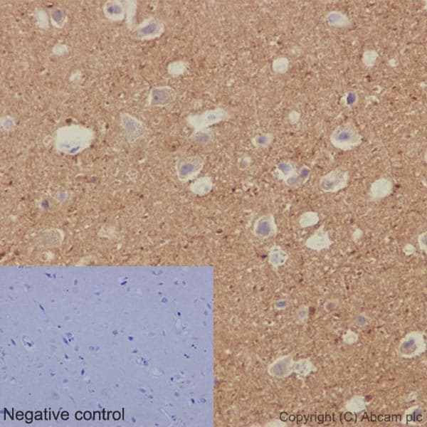 Anti-beta IV Tubulin antibody [EPR16775] - BSA and Azide free(AB250103)