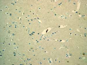 Anti-MUC16 antibody [EPR1020(2)](AB110640)