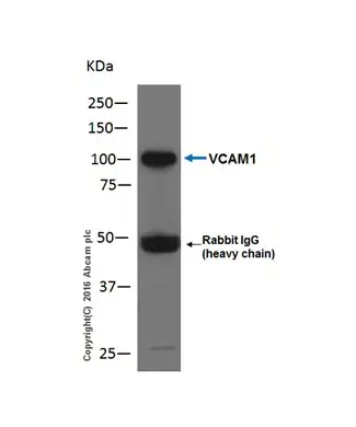 Anti-VCAM1 antibody [EPR5047](AB134047)