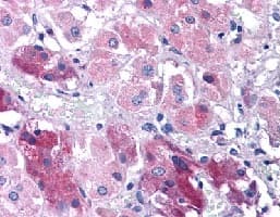 Abin3 Antibody Ab113748  Immunohistochemistry Formalin Pfa Fixed Paraffin Embedded Sections Img113757