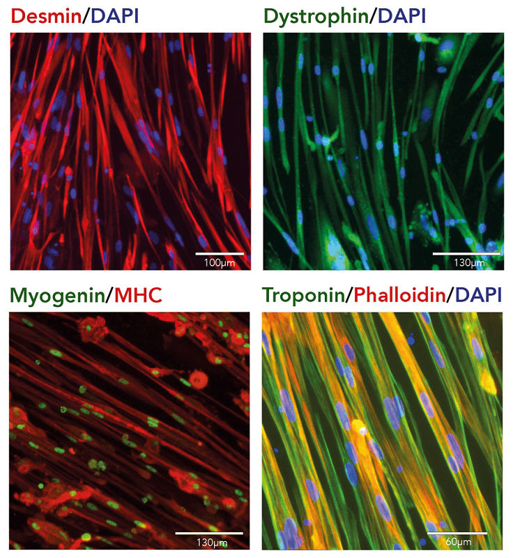 ioSkeletal Myocytes - Human iPSC derived cells(AB277612)