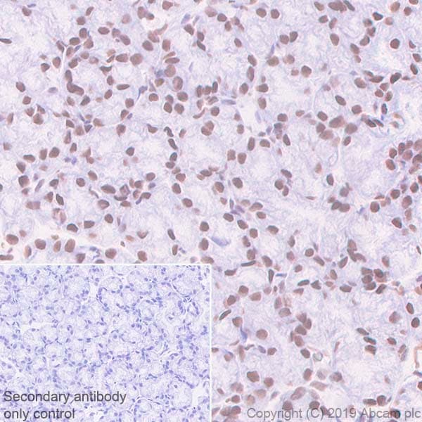 Anti-BRG1 antibody [EPR3912](AB108318)
