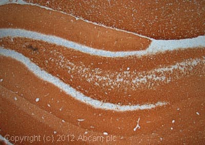 Anti-VGluT1 antibody [N28-9](AB134283)