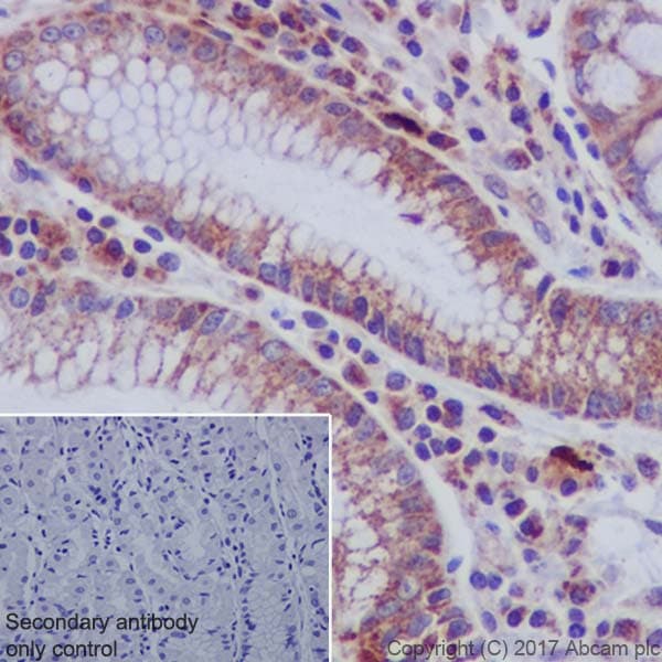 Ndufs4 Antibody Ep7832 Bsa And Azide Free Ab232337  Immunohistochemistry Formalin Pfa Fixed Paraffin Embedded Sections Img113874