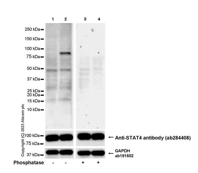 Anti-STAT4 antibody [EPR25128-48](AB284408)