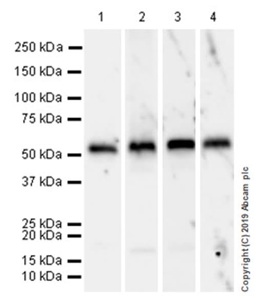 Anti-EFEMP1/Fibulin-3 antibody [EPR22855-4](AB256457)