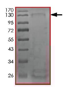 Recombinant Human CDK12 protein(AB204102)