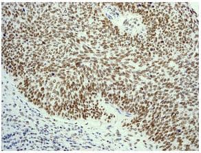 Dn 7 Antibody Epr5266 Bsa And Azide Free Ab248418  Immunohistochemistry Formalin Pfa Fixed Paraffin Embedded Sections Img129912