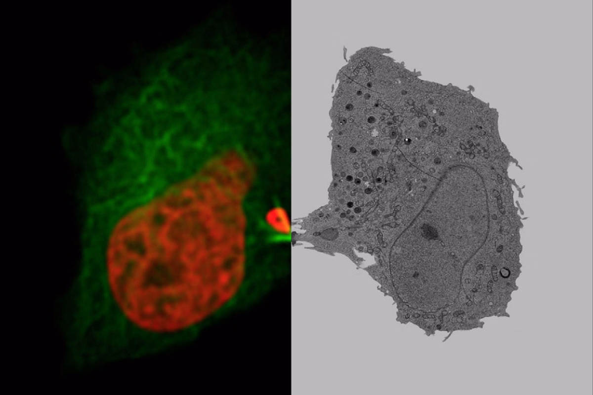 Mammalian Cells Expressing H2B MCherry And AlphaTubulin MEGFP Kid21767589