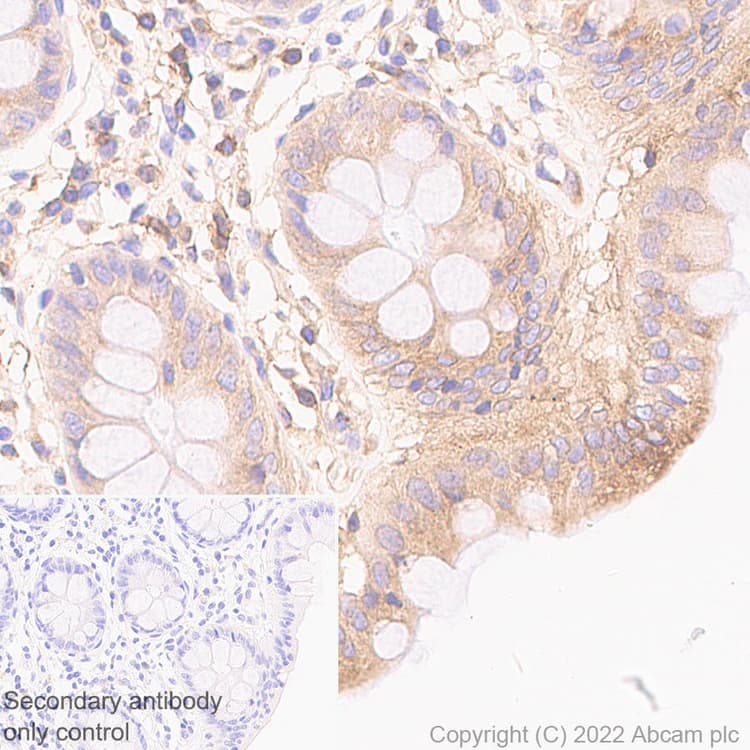 Anti-HLA-C antibody [EPR26121-73](AB307361)