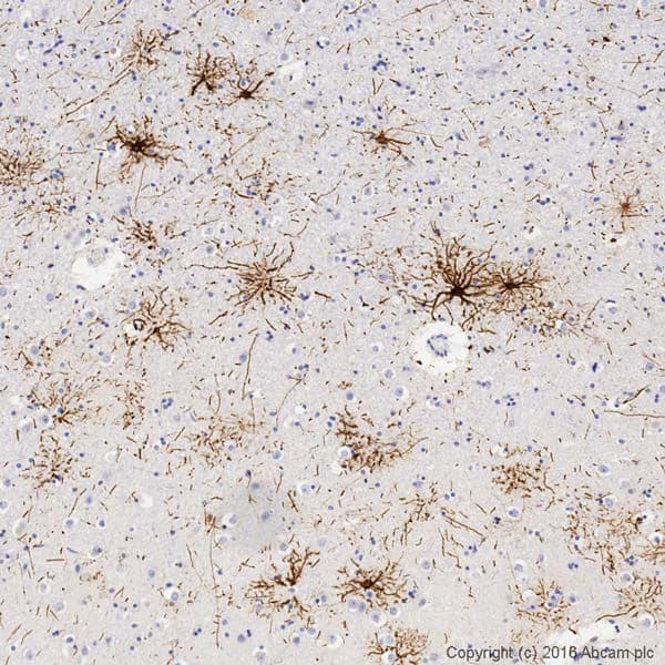 Gfap Antibody Epr1034y Ab68428  Immunohistochemistry Formalin Pfa Fixed Paraffin Embedded Sections Img40574