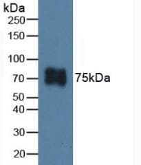Anti-ITGB6 antibody(AB233519)