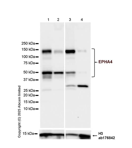 Anti-Histone H3 antibody [EPR16987] - Nuclear Marker and ChIP Grade(AB176842)
