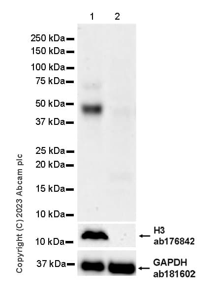 Anti-MATH2/NEUROD6 antibody [EPR28660-23](AB315812)