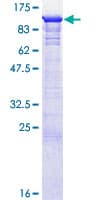 Recombinant Human eRF3/GSPT1 protein(AB132287)
