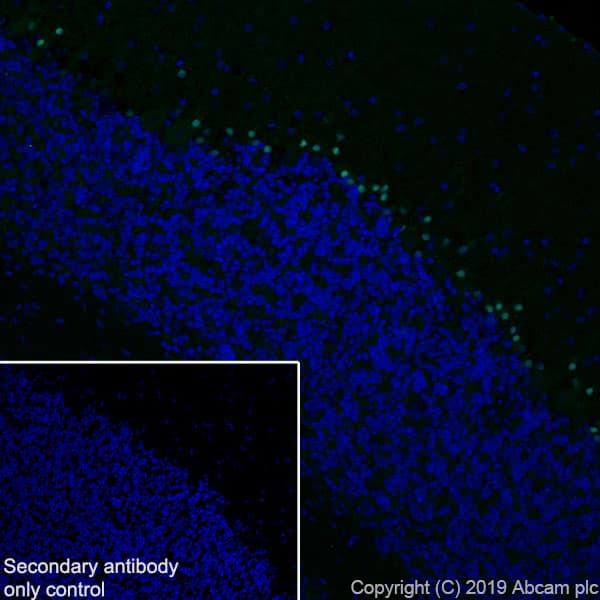Sox1 Antibody Epr23041 60 Bsa And Azide Free Ab263870  Immunohistochemistry Frozen Sections Img97