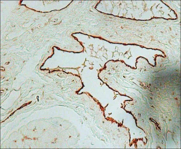 Anti-Von Willebrand Factor antibody(ab6994)