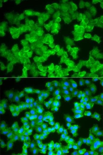 S100a12 Cgrp Antibody Ab196740  Immunocytochemistry Immunofluorescence Img131527