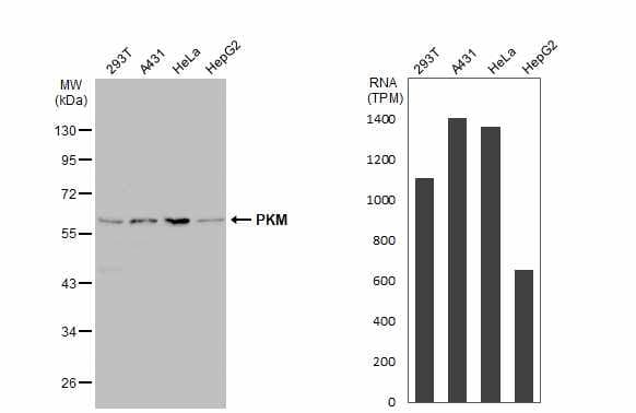 Pkm Antibody Ab137852  Western Blot Img449701