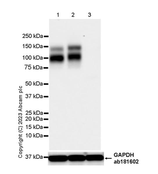 Trkc Antibody Epr22959 404 Ab313761  Western Blot Img418985