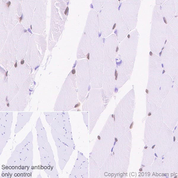 Six1 Antibody 1593 Ab243247  Immunohistochemistry Formalin Pfa Fixed Paraffin Embedded Sections Img135543