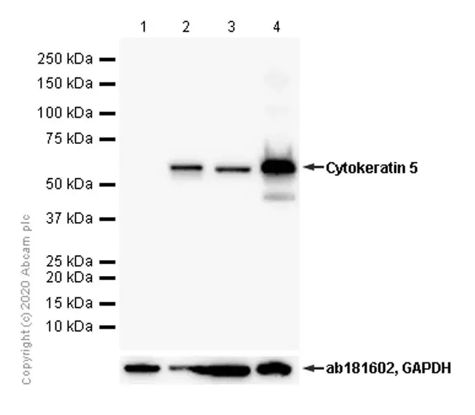 Anti-Cytokeratin 5 antibody [EP1601Y] - Cytoskeleton Marker(AB52635)