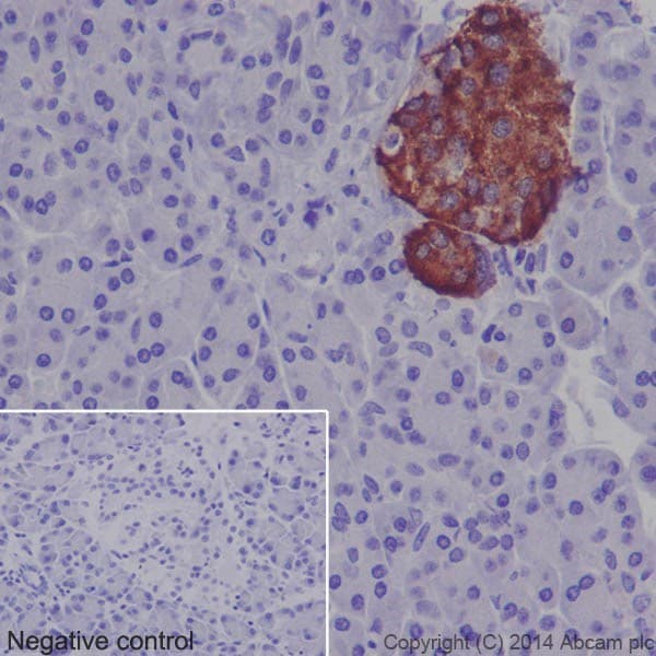 Anti-Insulin antibody [EPR17359](AB181547)
