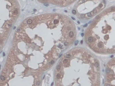 Cd300c Antibody Ab232789  Immunohistochemistry Formalin Pfa Fixed Paraffin Embedded Sections Img54954