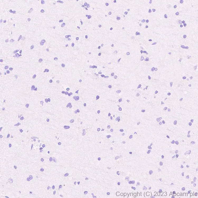 Anti-Streptococcus mutans Cell surface antigen I/II antibody [EPR28235-11](AB316006)