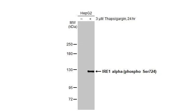 Anti-IRE1 alpha (phospho Ser724) antibody [HL1885](ab308387)