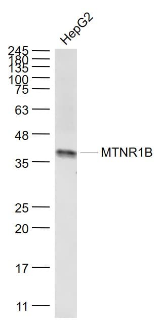 Anti-Melatonin Receptor 1B/MTNR1B antibody(AB203346)