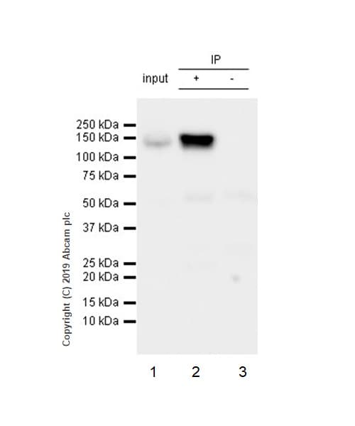 Anti-RENT1/hUPF1 antibody [EPR4681](AB109363)