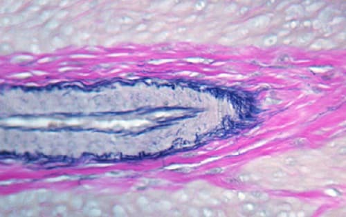 Elastic Stain Kit (Verhoeff Van Gieson / EVG Stain)(AB150667)