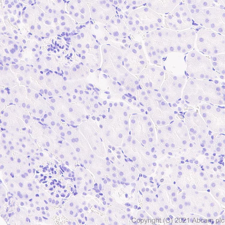 Aire Antibody Epr24411 22 Bsa And Azide Free Ab283663  Immunohistochemistry Formalin Pfa Fixed Paraffin Embedded Sections Img170095