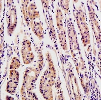 Anti-Osteopontin antibody(AB216406)