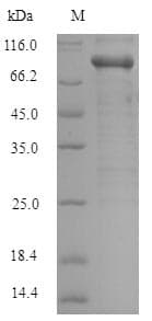 Recombinant Human PAK1 protein (Tagged)(AB238241)