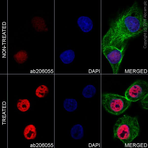 Alexa Fluor 647 P53 Acetyl K373 Antibody Ep3562ay Ab206055  Immunocytochemistry Immunofluorescence Img87633