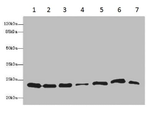 Anti-Proteasome 20S beta 3 antibody(AB230024)