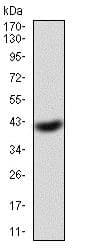 Eif5a Antibody 4e10f6 Ab204939  Western Blot Img162097