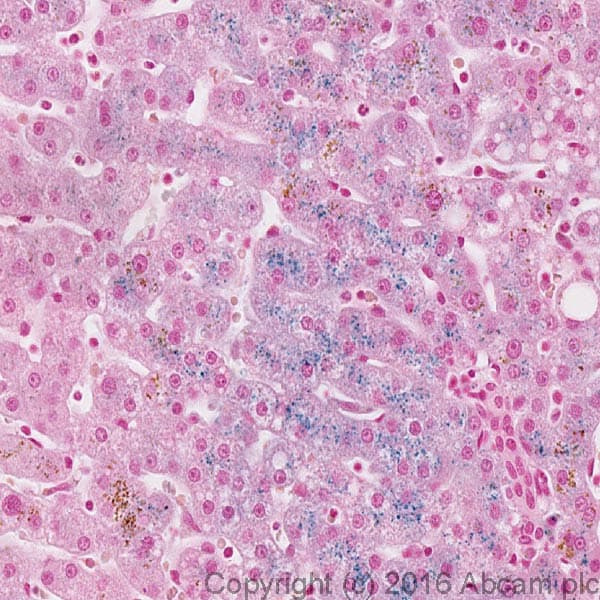 Iron Stain Kit (Prussian Blue Stain)(AB150674)