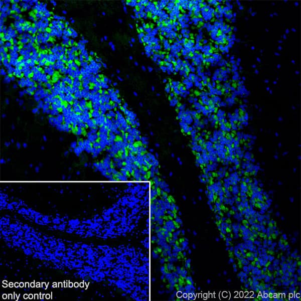 Anti-GABRD antibody [EPR25324-253](AB300348)