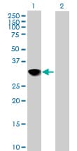 Cenph Antibody Ab88593  Western Blot Img153650