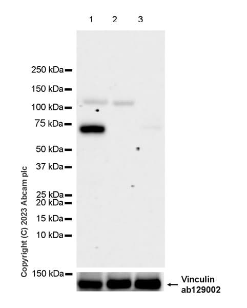 68kda Neurofilament Nf L C Term Antibody Epr28784 63 Bsa And Azide Free Ab315815  Western Blot Img425396