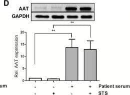 Anti-alpha 1 Antitrypsin antibody [EPR17087-50](AB207303)