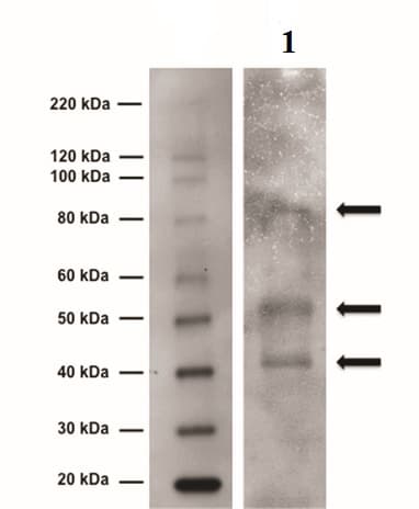 Anti-Tyrosine Hydroxylase antibody(AB6211)