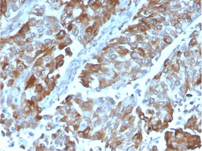 Cd134 Ox40l Receptor Antibody Ox40 3108 Ab270727  Immunohistochemistry Formalin Pfa Fixed Paraffin Embedded Sections Img99673