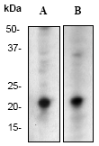 Anti-GTPase HRAS antibody [Y132](AB32417)