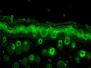Rab5 Antibody Early Endosome Marker Ab13253  Immunohistochemistry Formalin Pfa Fixed Paraffin Embedded Sections Img50925