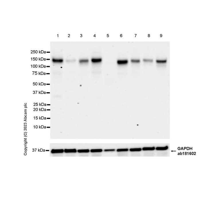 Anti-KIAA0319L antibody [EPR28329-62](AB315027)